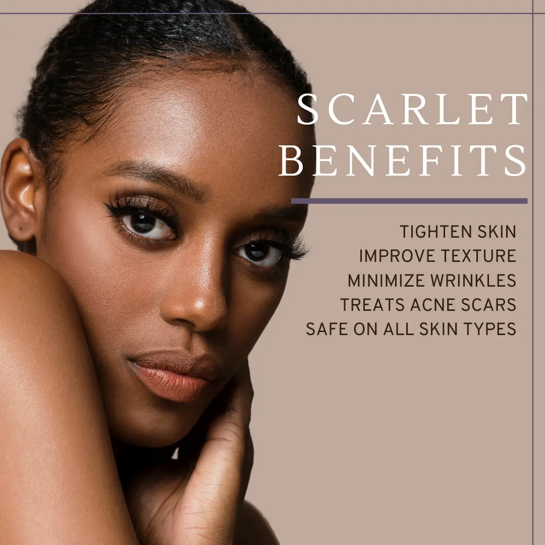 Scarlet benefits